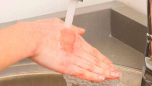 Kuyganda nima qilish mumkin-u, nima qilish mumkin emas?