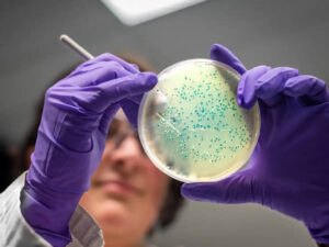 Antibiotiklarga chidamlilik sabab 2050-yilgacha 40 mln kishi o‘lishi mumkin